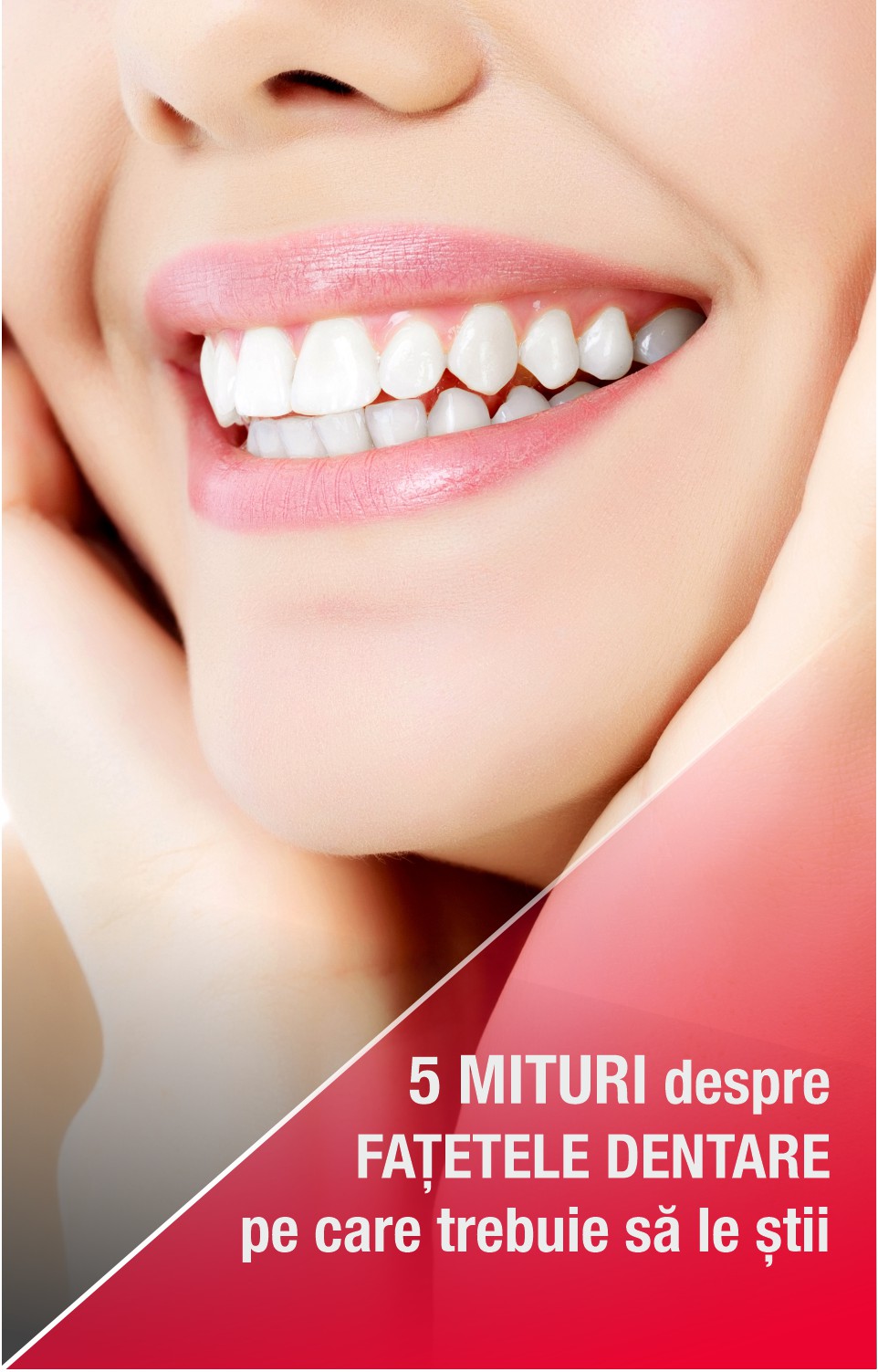 Cinci mituri despre fațetele dentare pe care trebuie să le știi