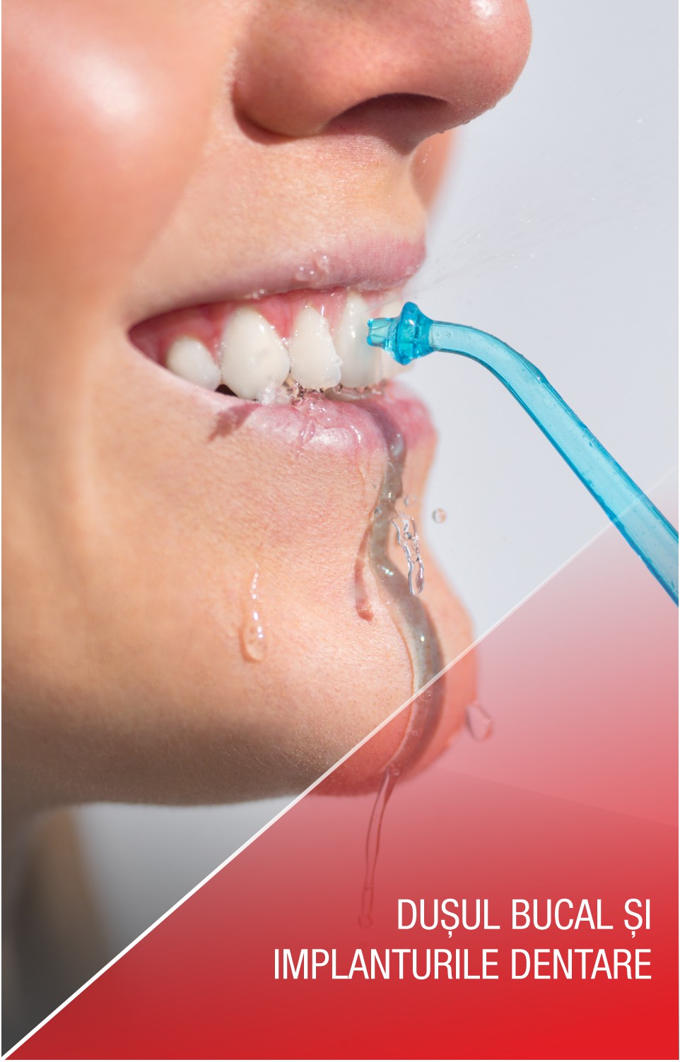 Dușul bucal: de ce este important atunci când ai implanturi dentare?